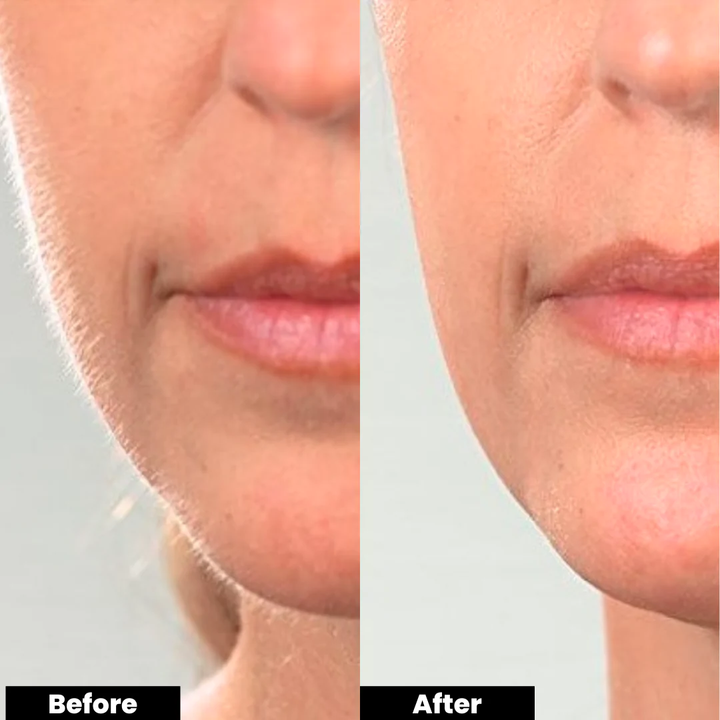 The Whisker Fixer™ Facial Hair Remover