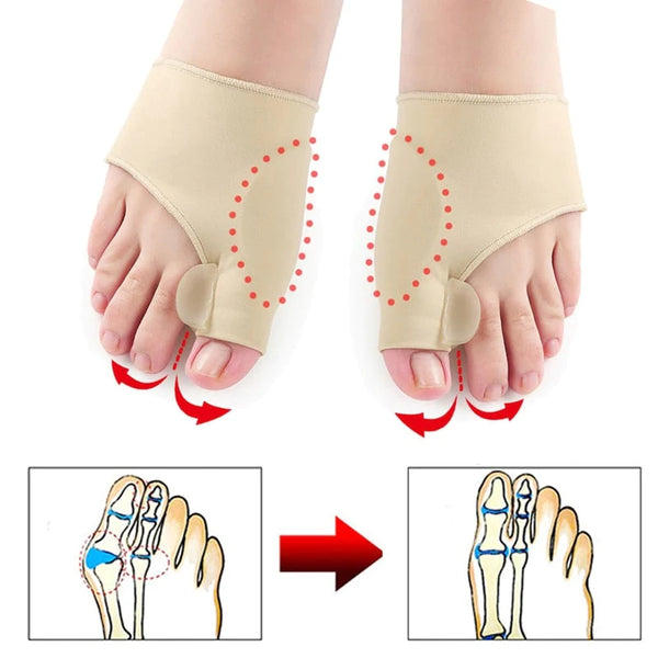 Premie Bunion Corrector Sok 1 Paar ( 1 Links + 1 Rechts )